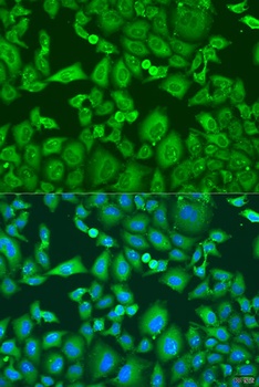 KIF11 Antibody