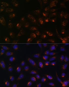 ITPR1 Antibody