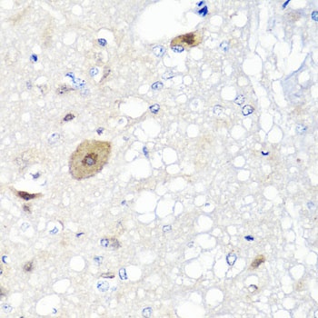 FGF13 Antibody