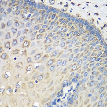 EEF1G Antibody