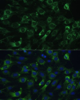 EEF1G Antibody