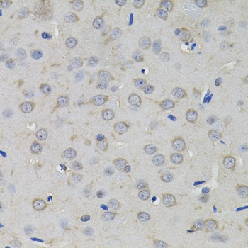 AMPD1 Antibody