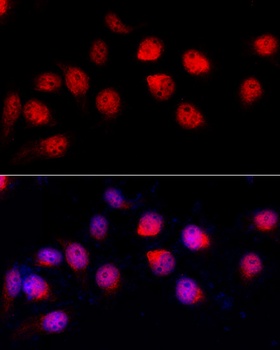 ADAR Antibody