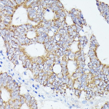 ACAT2 Antibody