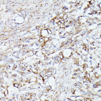 ACAT2 Antibody