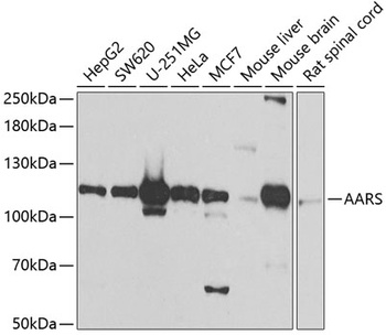 AARS Antibody