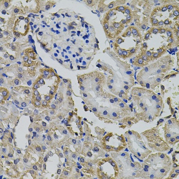 AARS Antibody