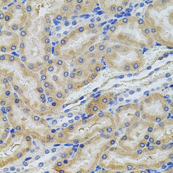 PCSK9 Antibody