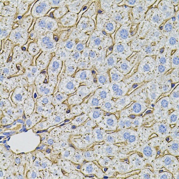 PCSK9 Antibody