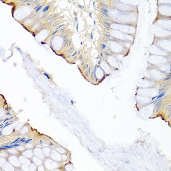 LRG1 Antibody