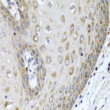 LRG1 Antibody