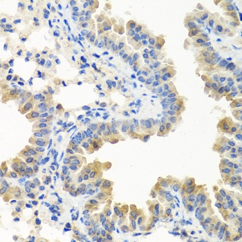 LRG1 Antibody