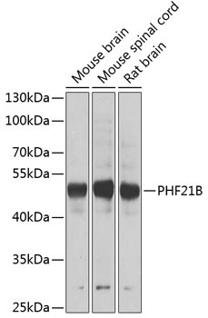PHF21B Antibody