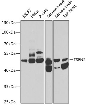 TSEN2 Antibody