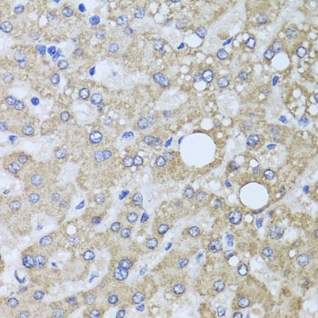 AARS2 Antibody