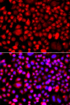 ALG1 Antibody