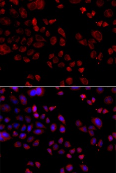 SLC22A11 Antibody