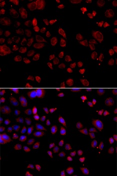 SLC22A11 Antibody