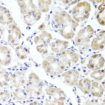 ALKBH4 Antibody