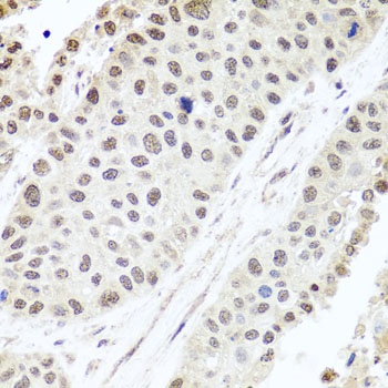 ALKBH4 Antibody