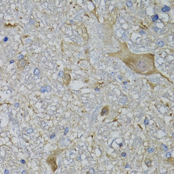 CALML5 Antibody
