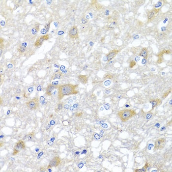 INPP5K Antibody