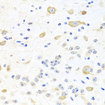 INPP5K Antibody