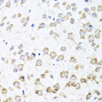 RPL36 Antibody