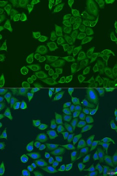 RPL36 Antibody