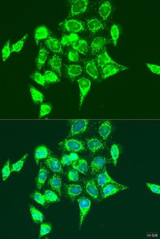 RASGRP3 Antibody