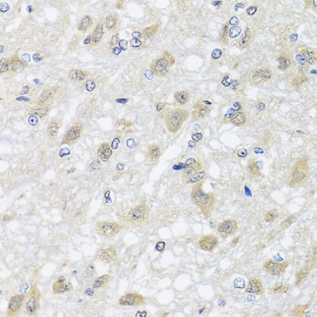 HARS2 Antibody