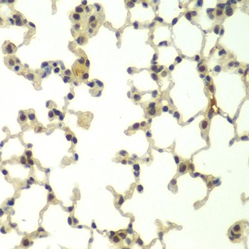 FBXW11 Antibody