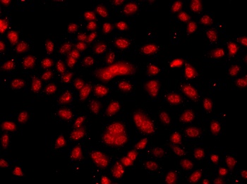 FBXW11 Antibody