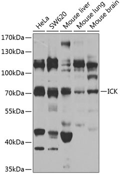 ICK Antibody