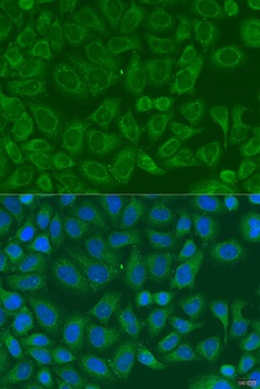 ICK Antibody