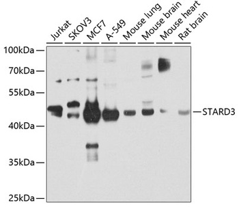 STARD3 Antibody