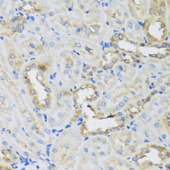 AHCYL1 Antibody