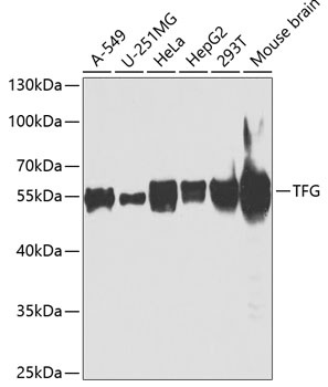 TFG Antibody