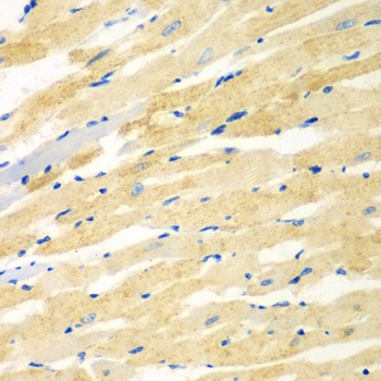 PDE4DIP Antibody