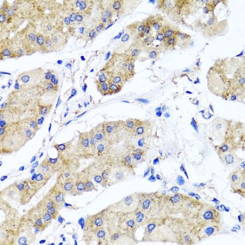 PSTPIP1 Antibody