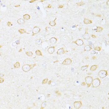 SQSTM1 / p62 Antibody