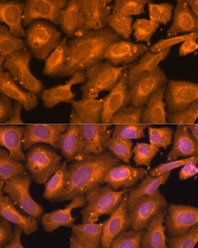 SQSTM1 / p62 Antibody