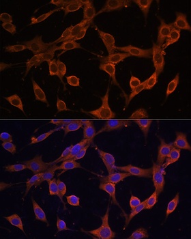 SQSTM1 / p62 Antibody