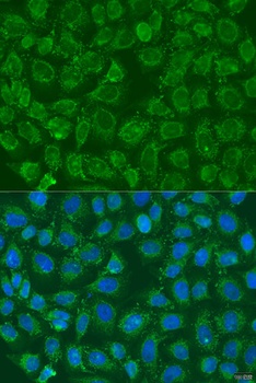 PIP5K1B Antibody