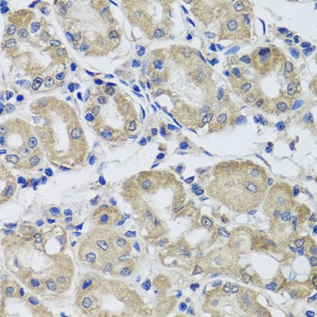 ST8SIA2 Antibody