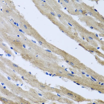 ST8SIA2 Antibody