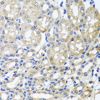 ST8SIA2 Antibody