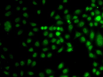 TRPS1 Antibody