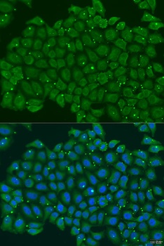 TNNC2 Antibody