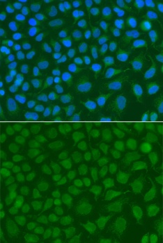 SSX5 Antibody